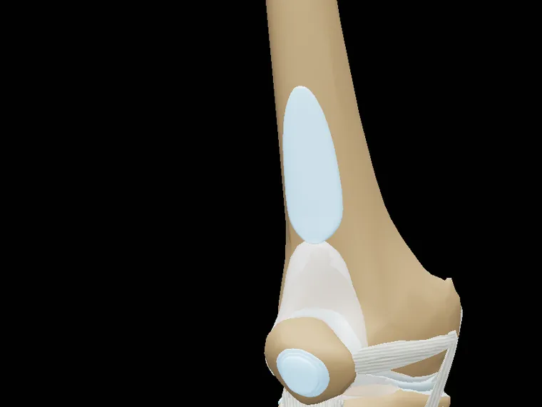 Ligamentos de la rodilla en el modelo 3D